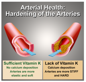 arteries-and-vitamin-k