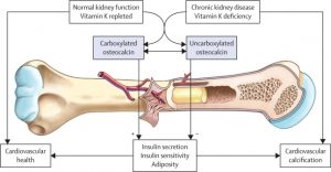 osteocalcin-and-bone-health