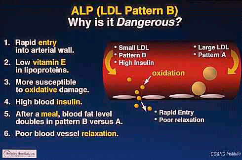 Pattern A vs Pattern B LDL risk